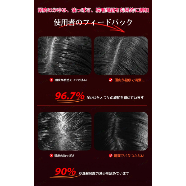 All Nippon™ ScalpWave 電気発毛ブラシ 赤外線ライトマシン付き ツボ頭皮マッサージ 抗脱毛運動 ヘアスクラバー コーム