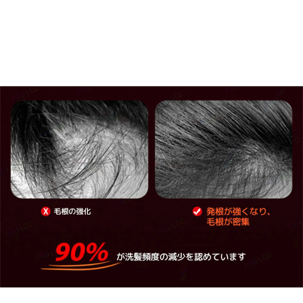 All Nippon™ ScalpWave 電気発毛ブラシ 赤外線ライトマシン付き ツボ頭皮マッサージ 抗脱毛運動 ヘアスクラバー コーム